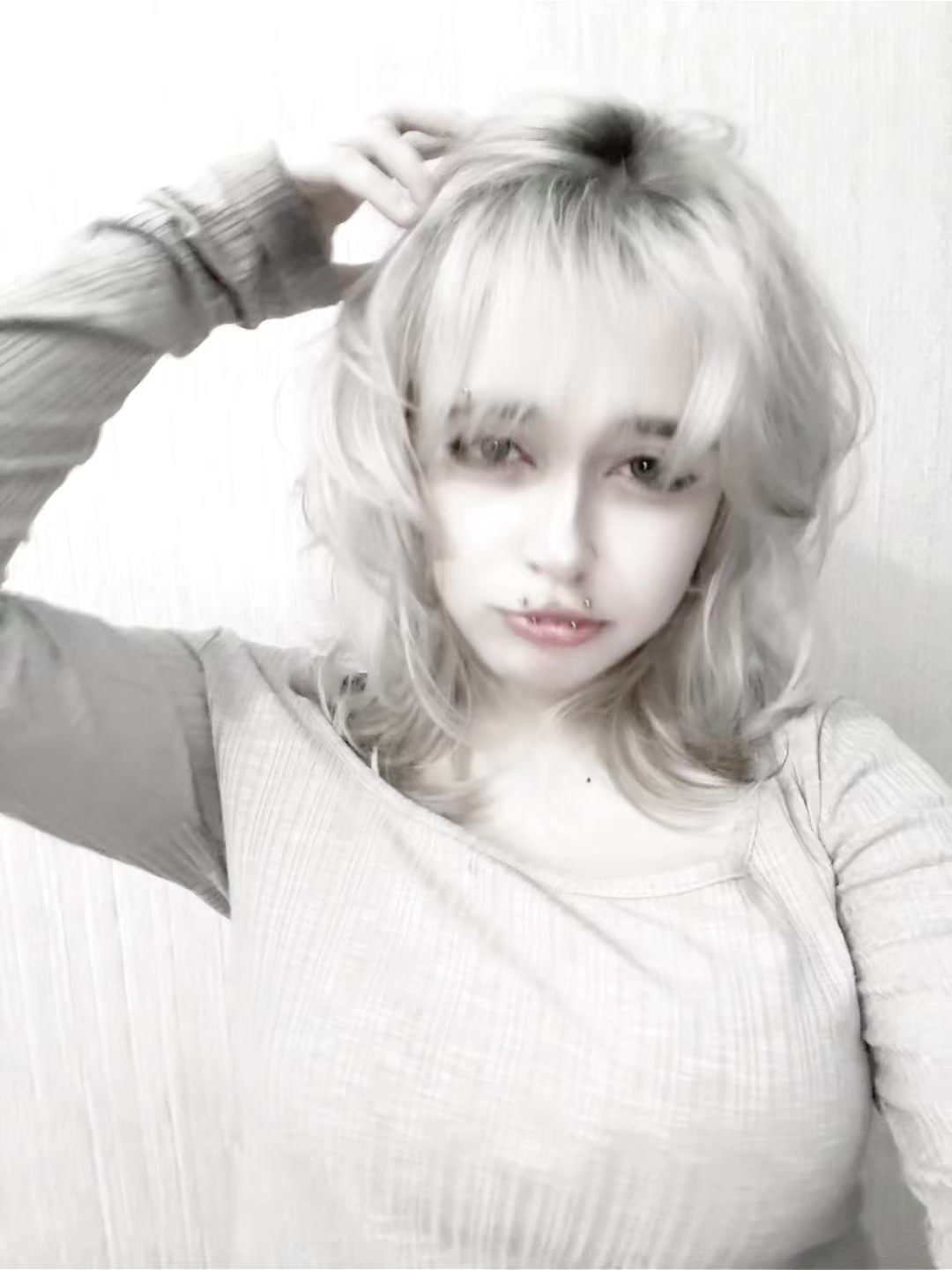 @uglyrosis