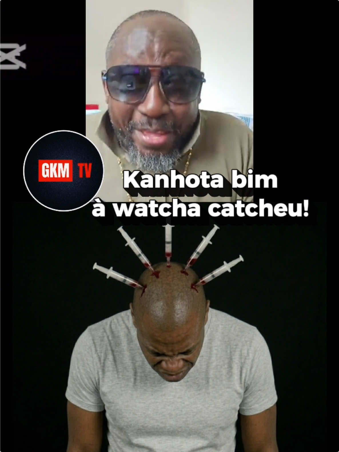 @Guin&eacute; Ka Mati TV