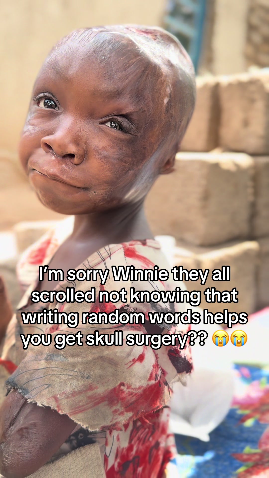 @Matayo Ssentongo