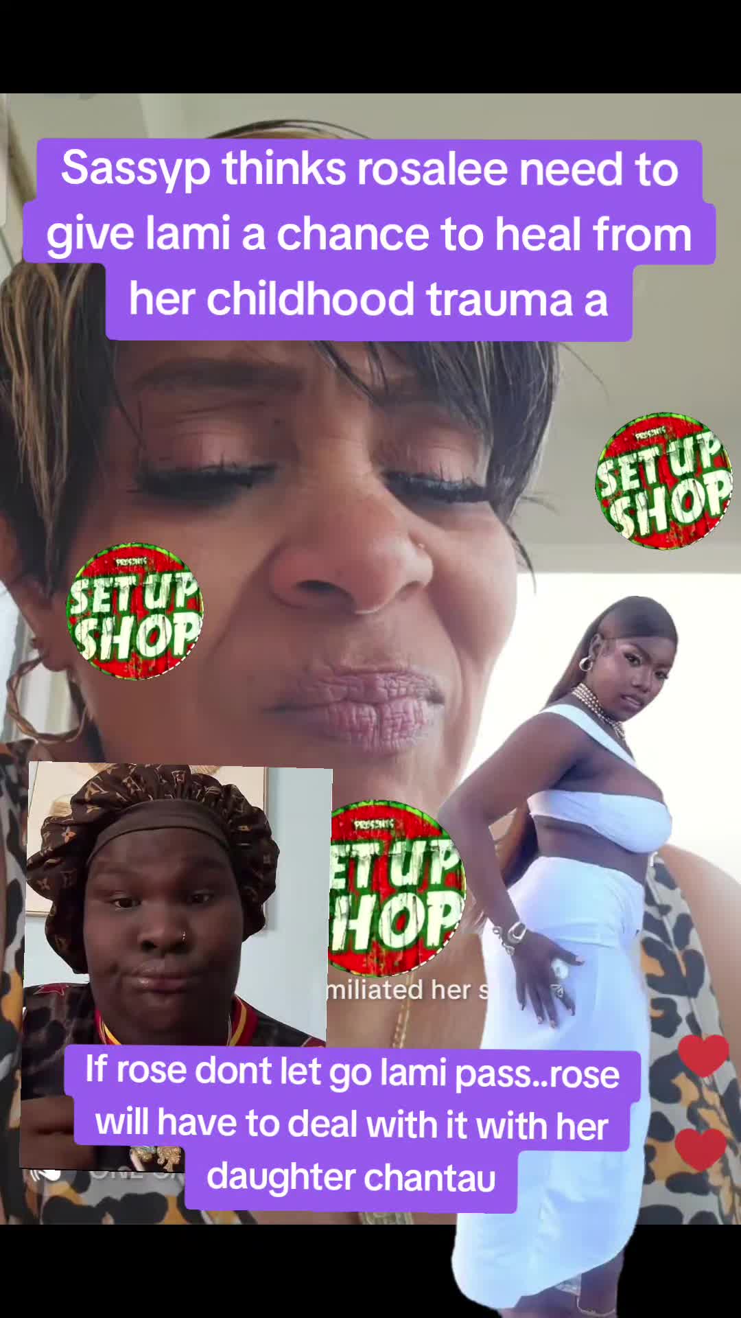 @SETUPSHOPLOG