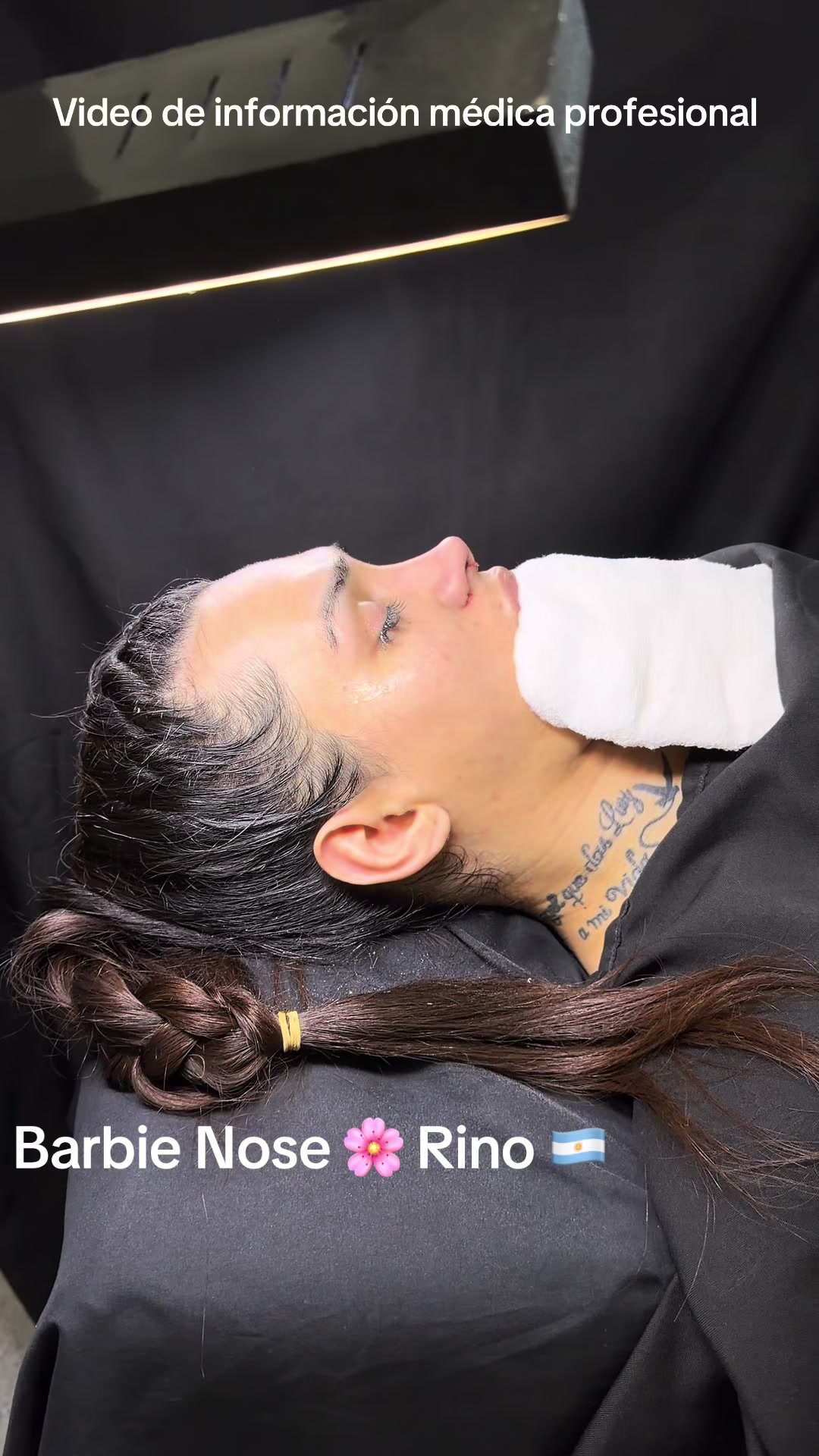 @drgarone.rinoplastia