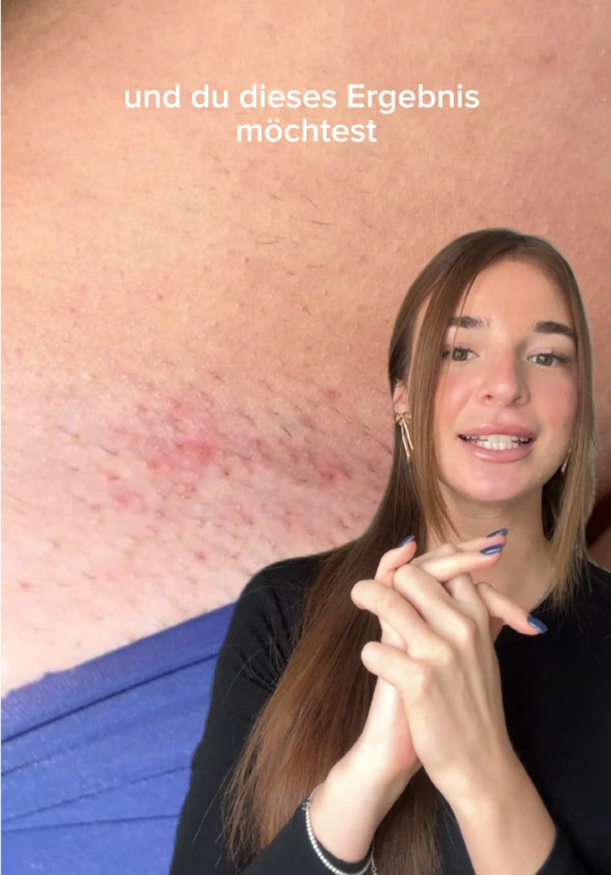 @Deine helfend gro&szlig;e Schwester