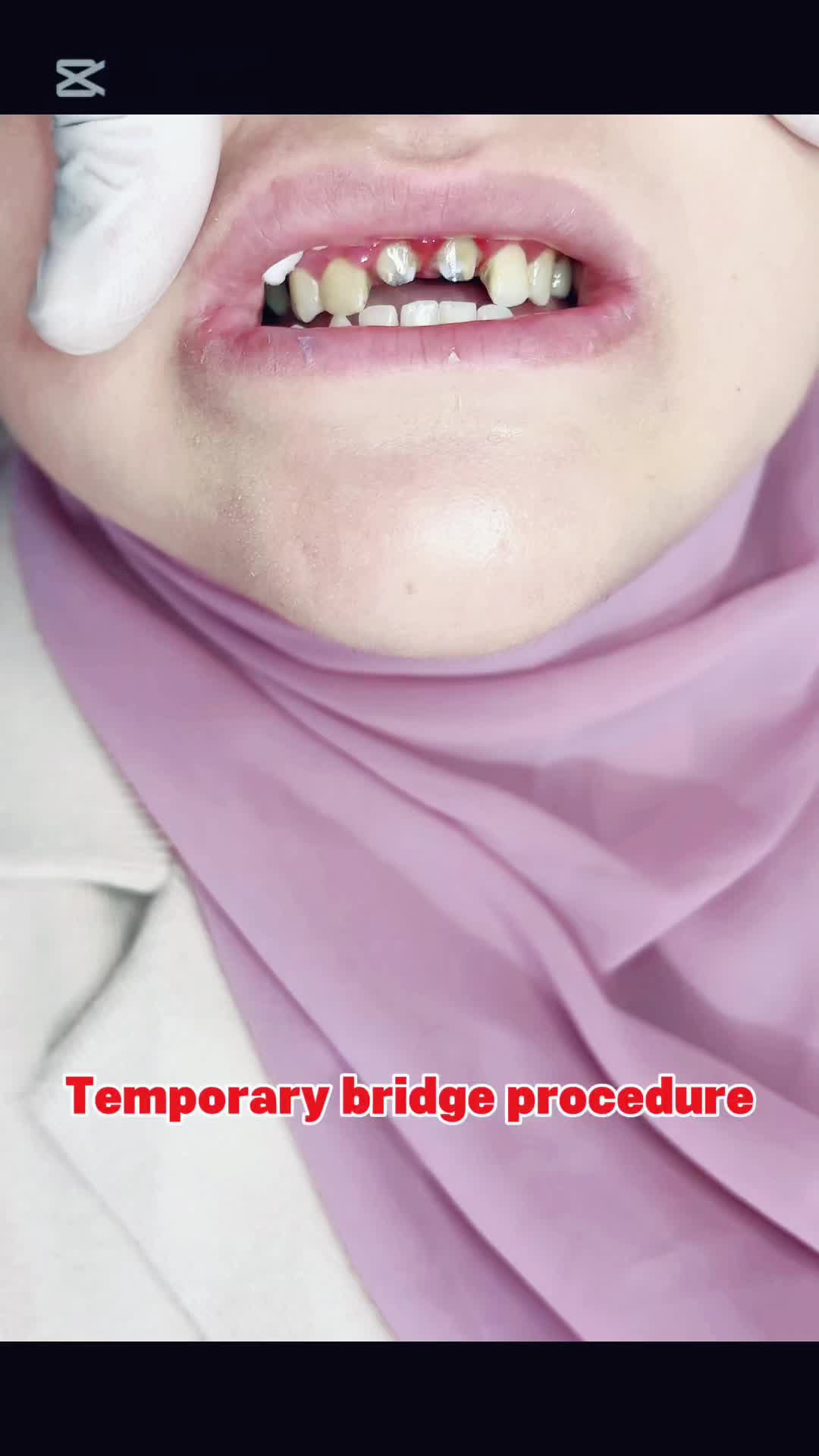 @Dr@Hadjout amer