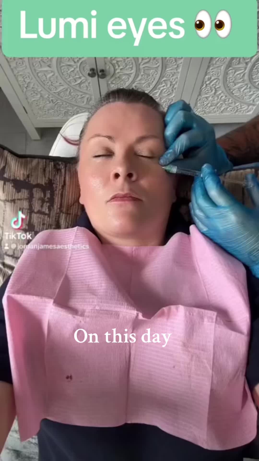 @jordan james aesthestics