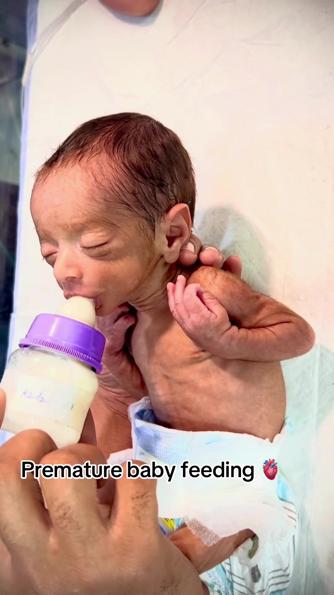 @🥼 CRITICAL NICU BABY 🩺