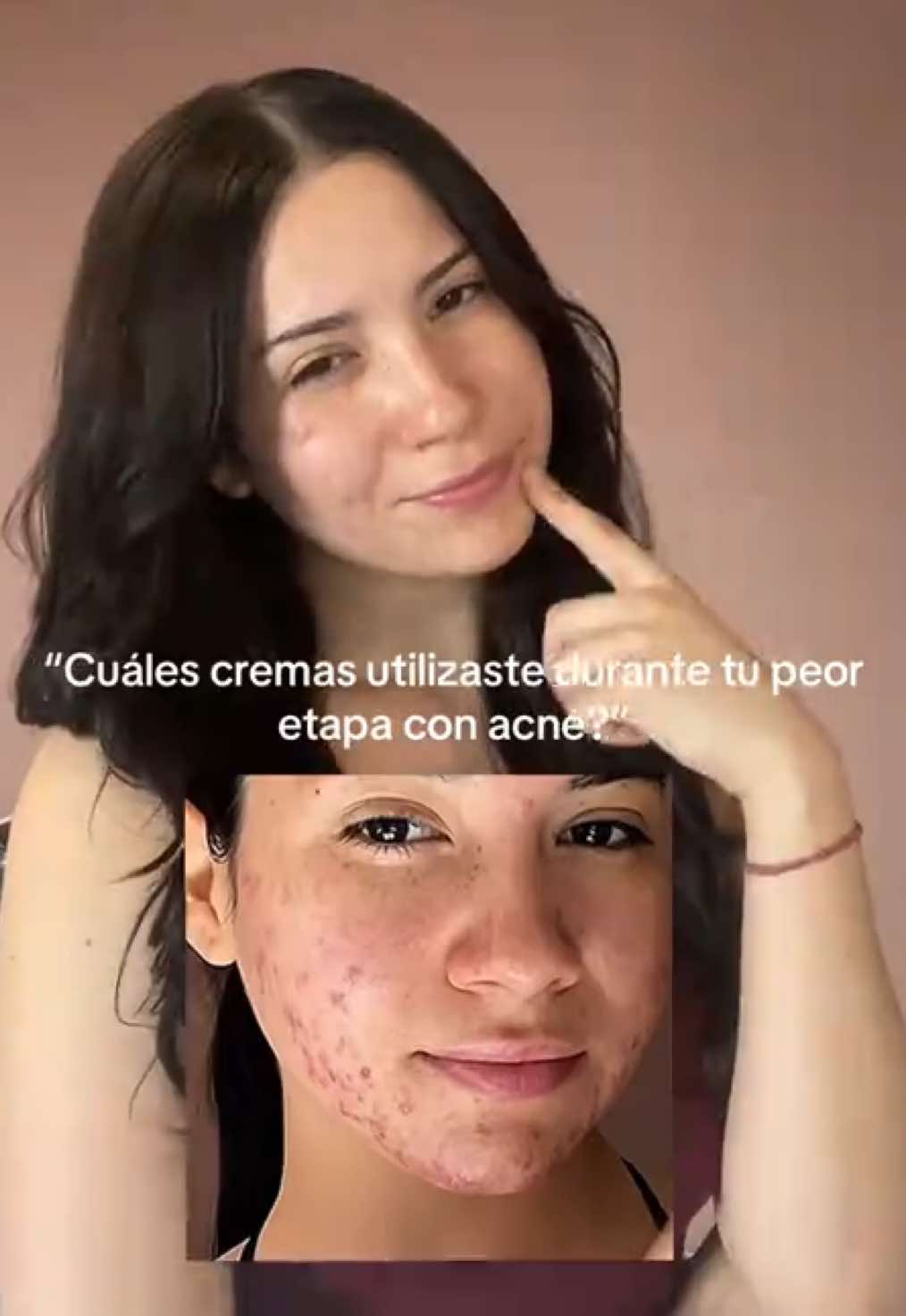 @Minli (Yoongi&rsquo;s gf)
