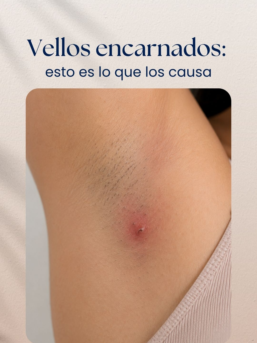 @M&aacute;sDepyl