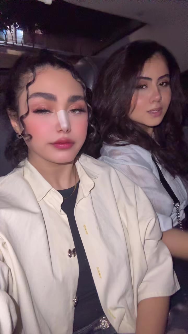 @MLA🍓