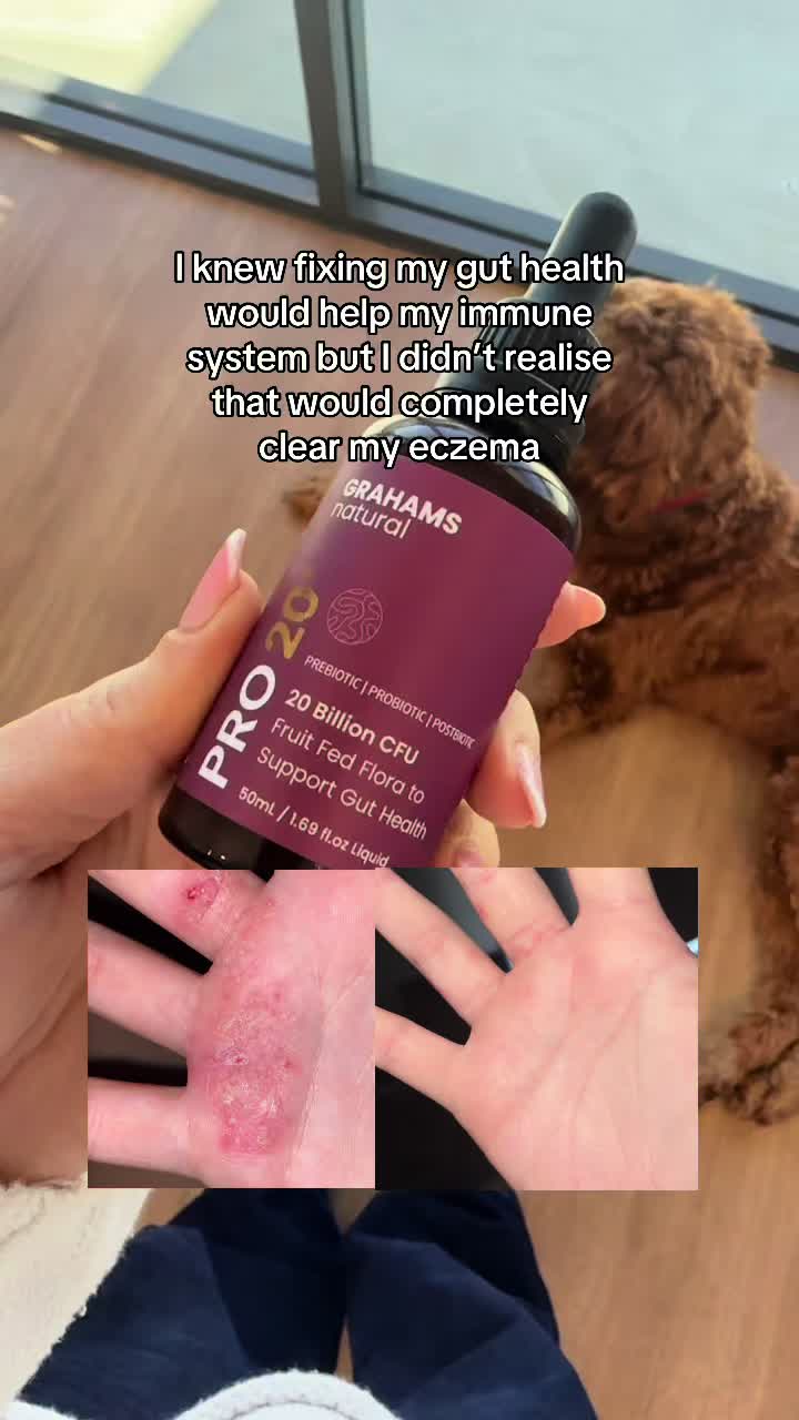 @Eczema Diaries USA & UK