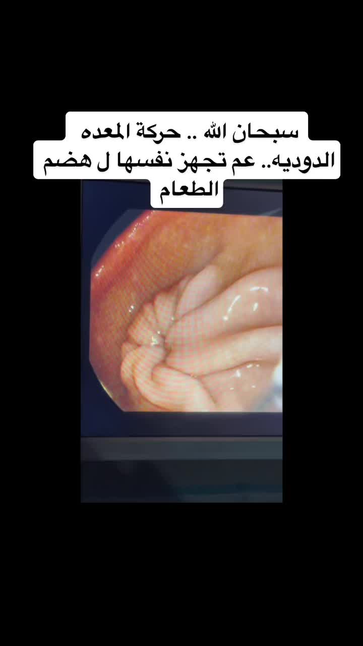 @Dr.AhmadRamadan