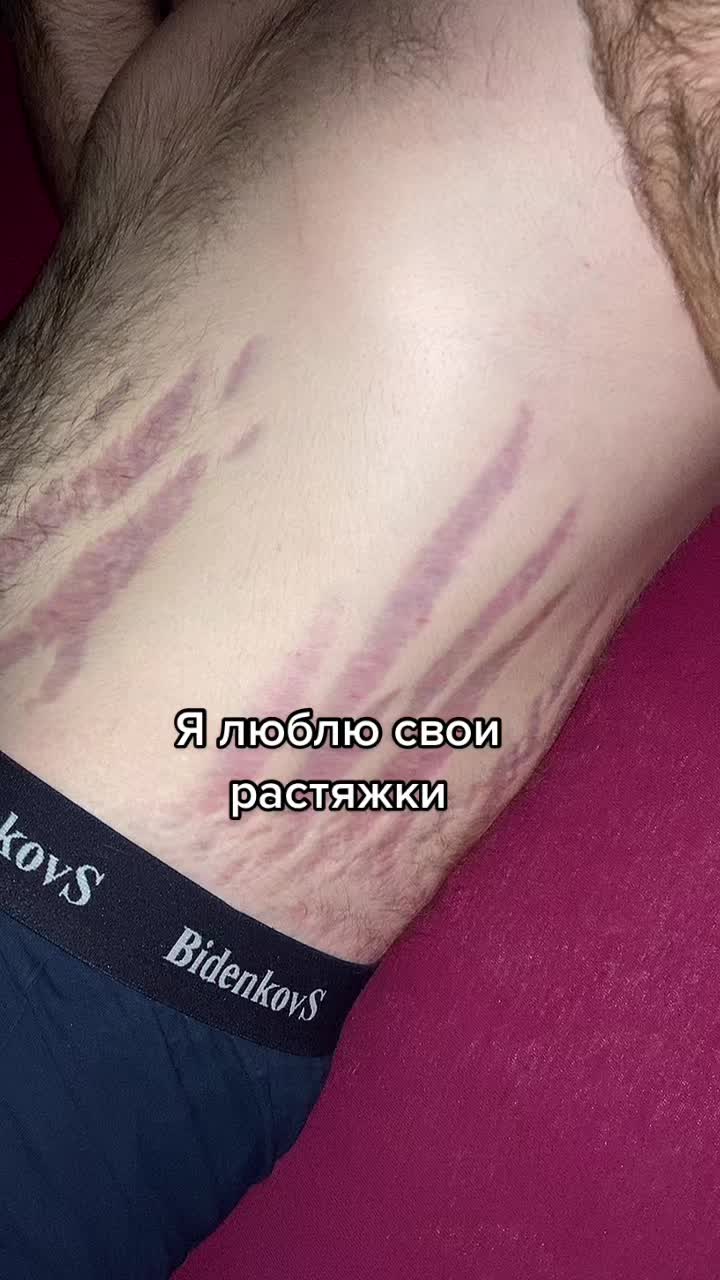 @ROMANSER22