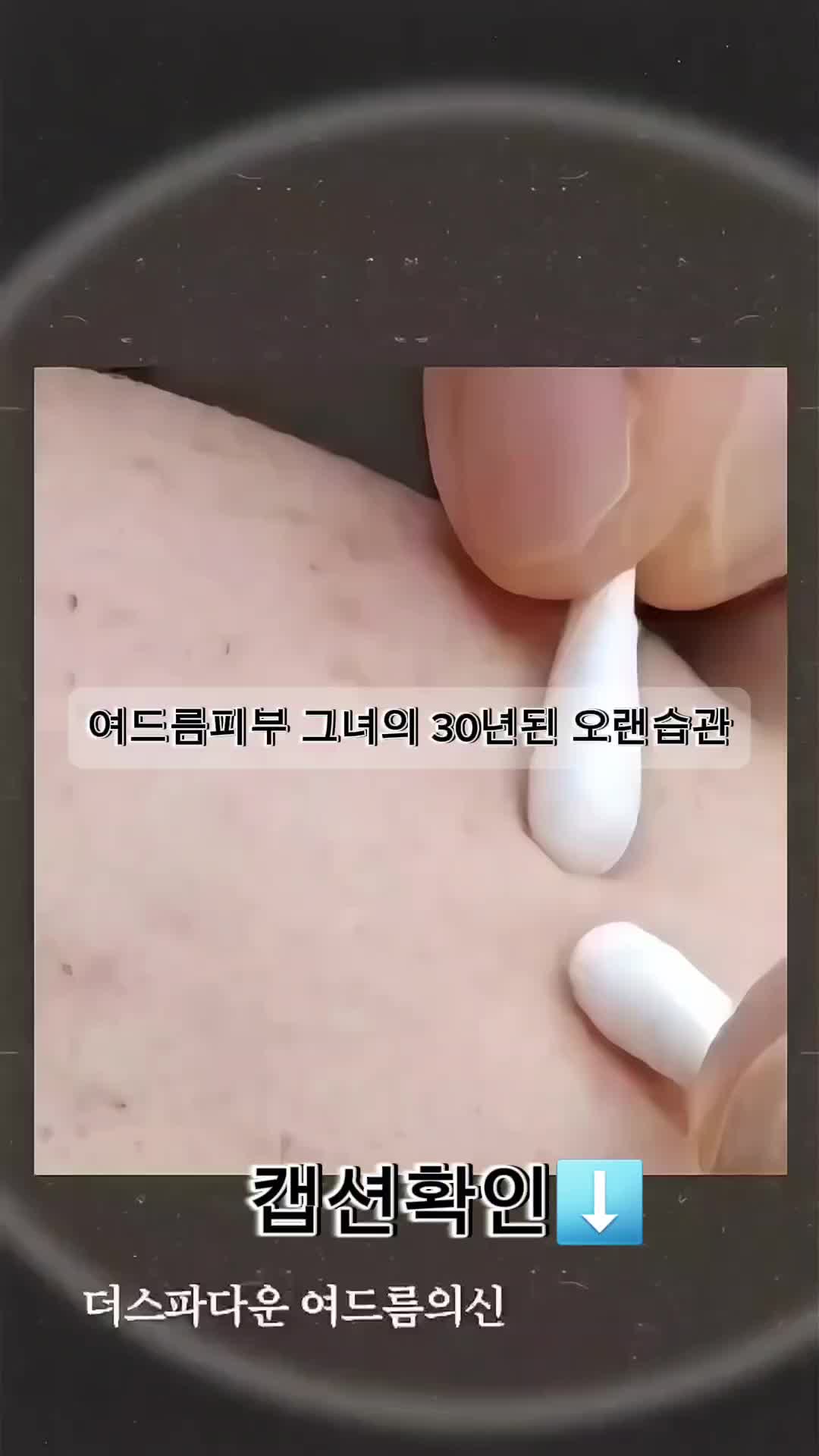 @더스파다운(여드름피부전문스파)