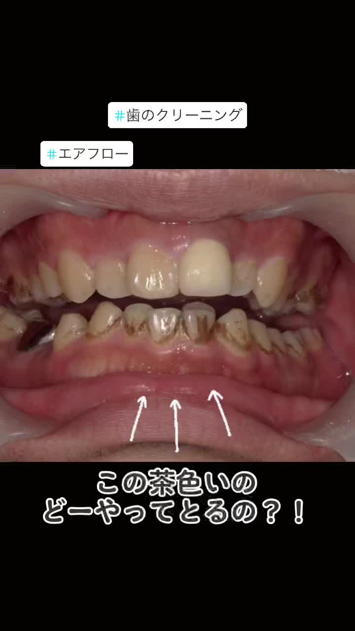 @DentalClinicPURE