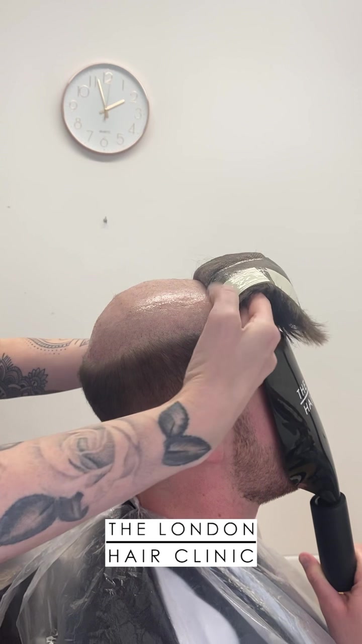 @TheLondonHairClinic
