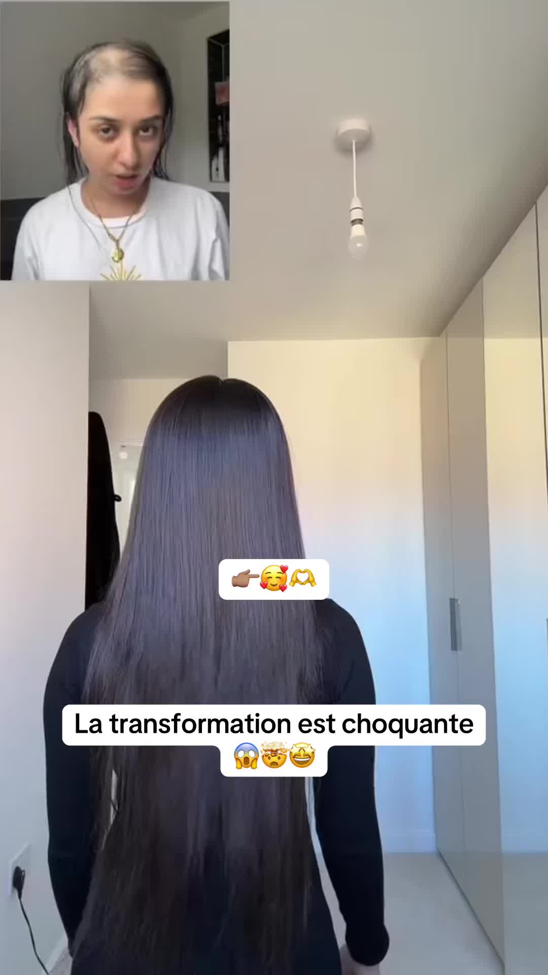 @Lux’Hair Growth
