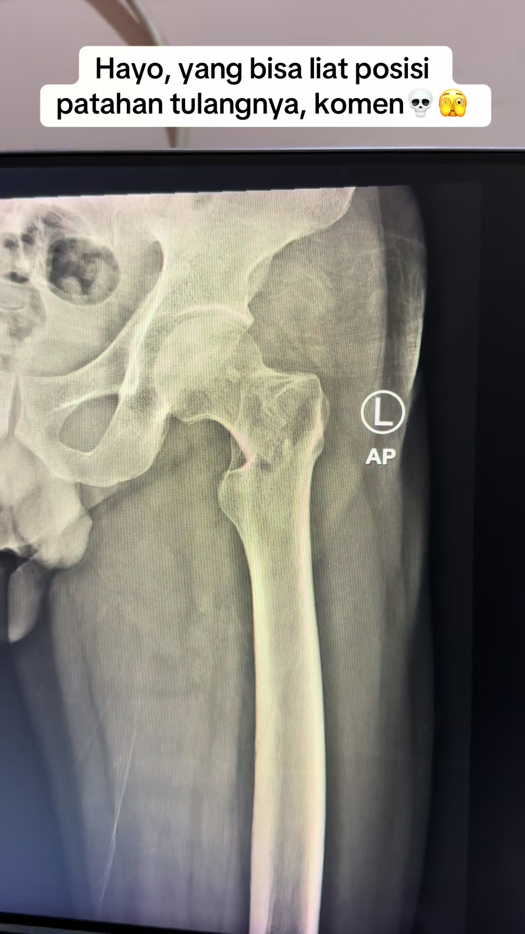 @Sobat Radiology
