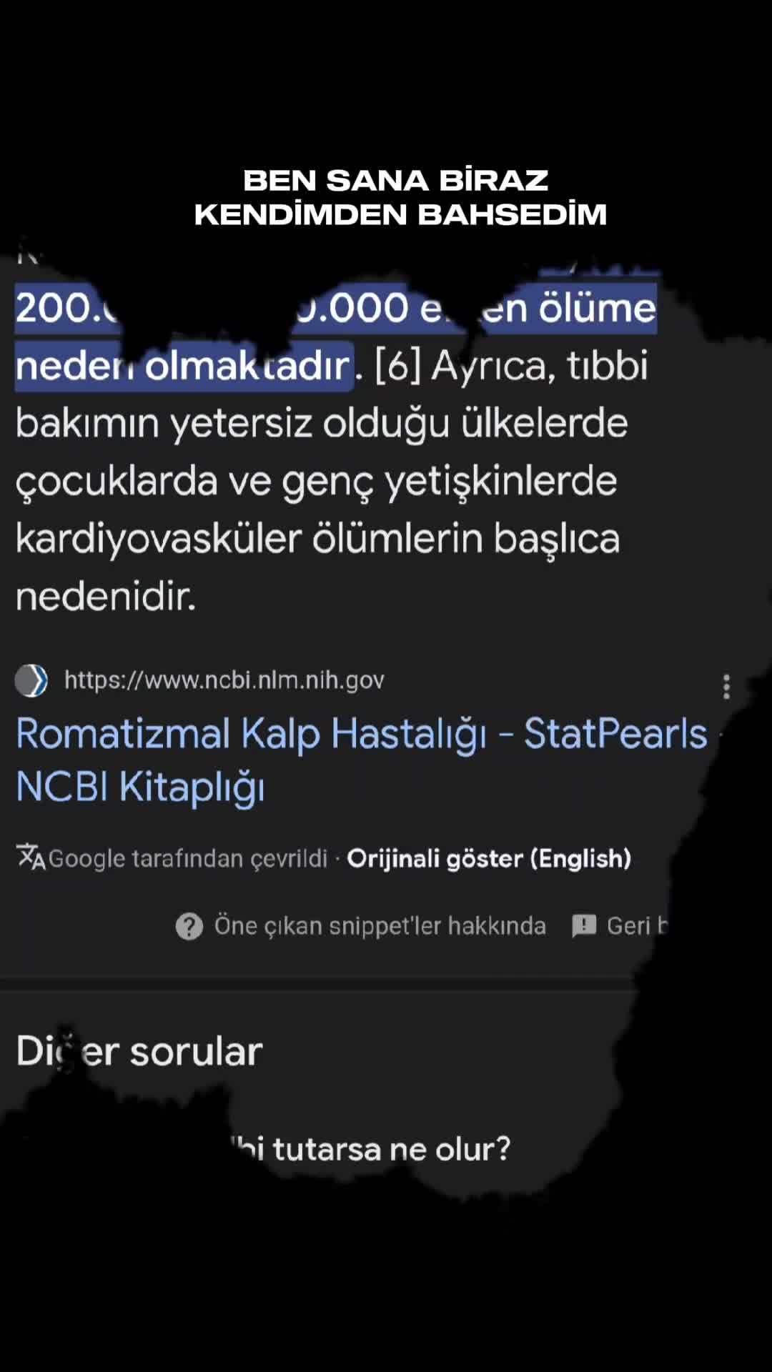 @XXXAPLUMUT