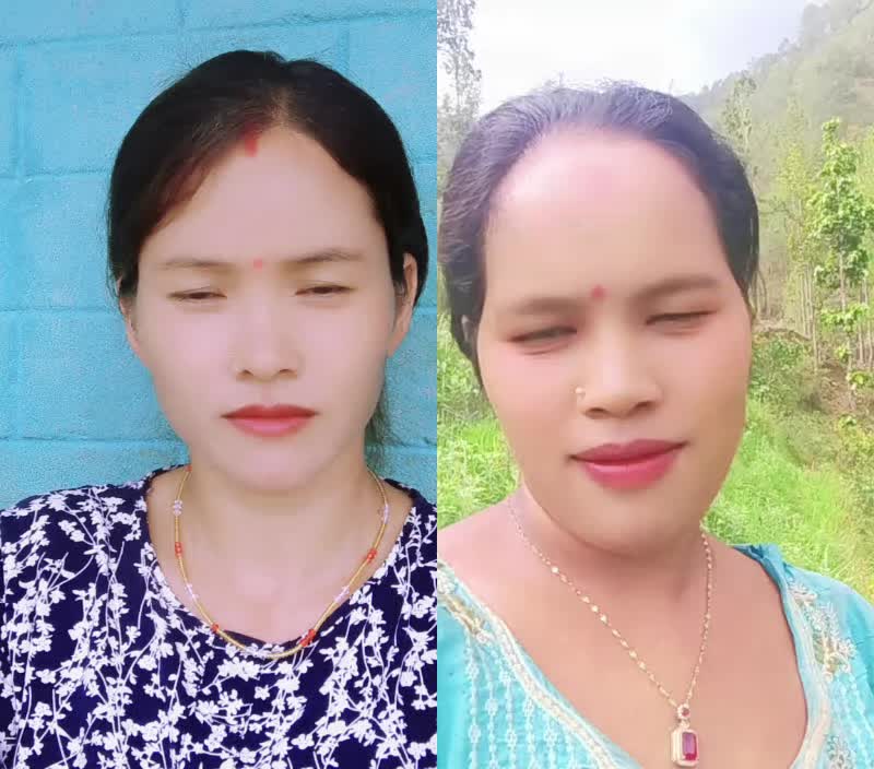 @Manisha Chalaune