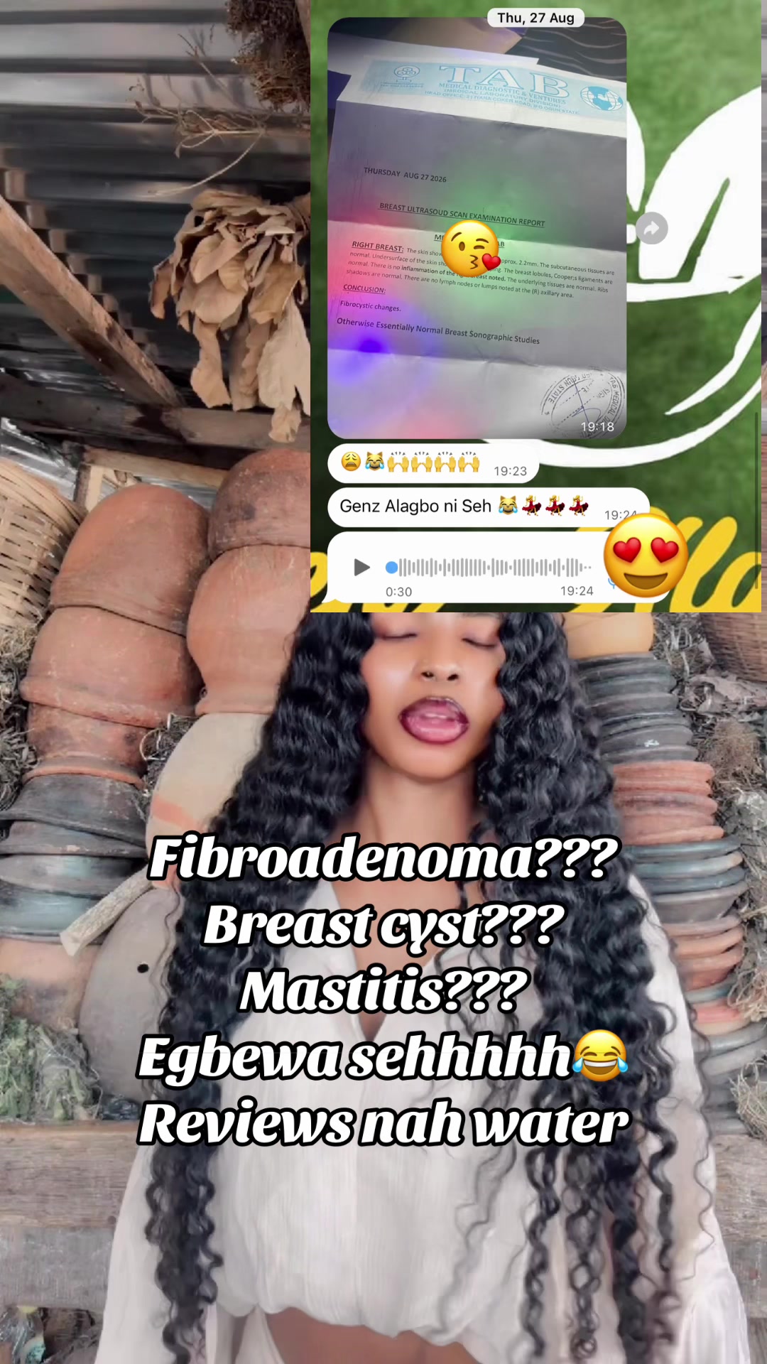 @GeNz_alagbo🐍🍯