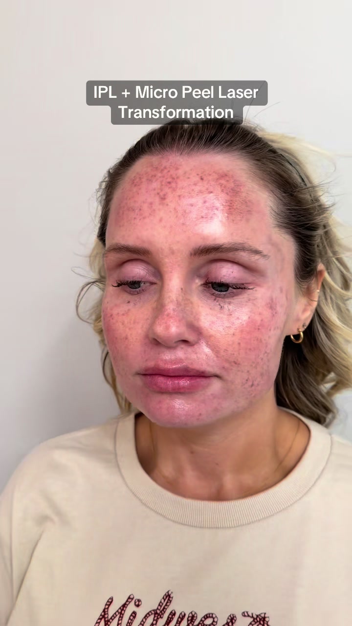 @Mona Dermatology | Cincinnati