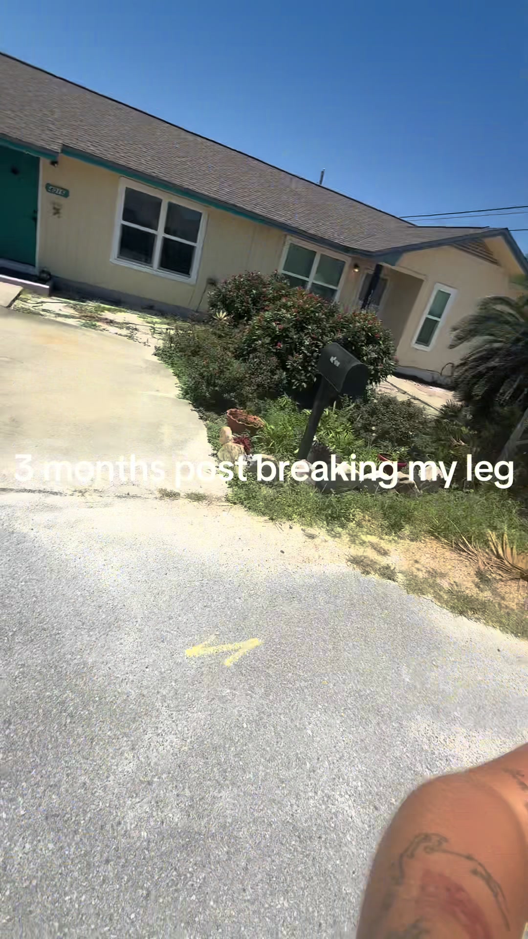 @🪩kp🪩