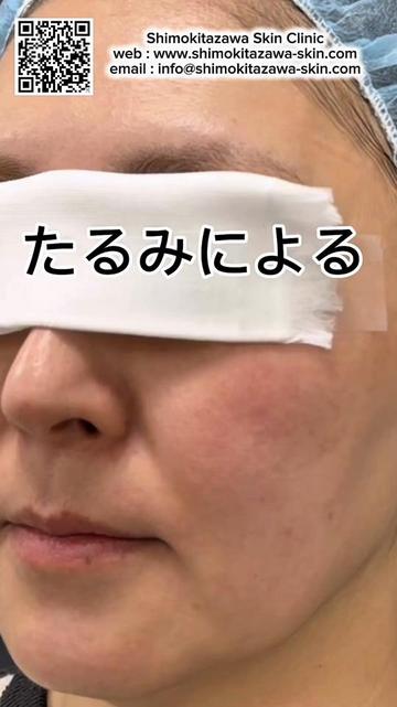 @下北沢スキンクリニック院長・こころの美容外科医・保坂宗孝