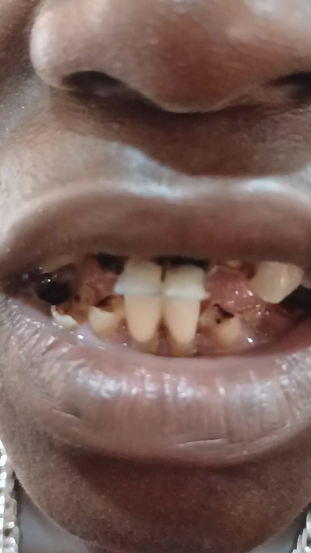 @Djoballa le dentiste