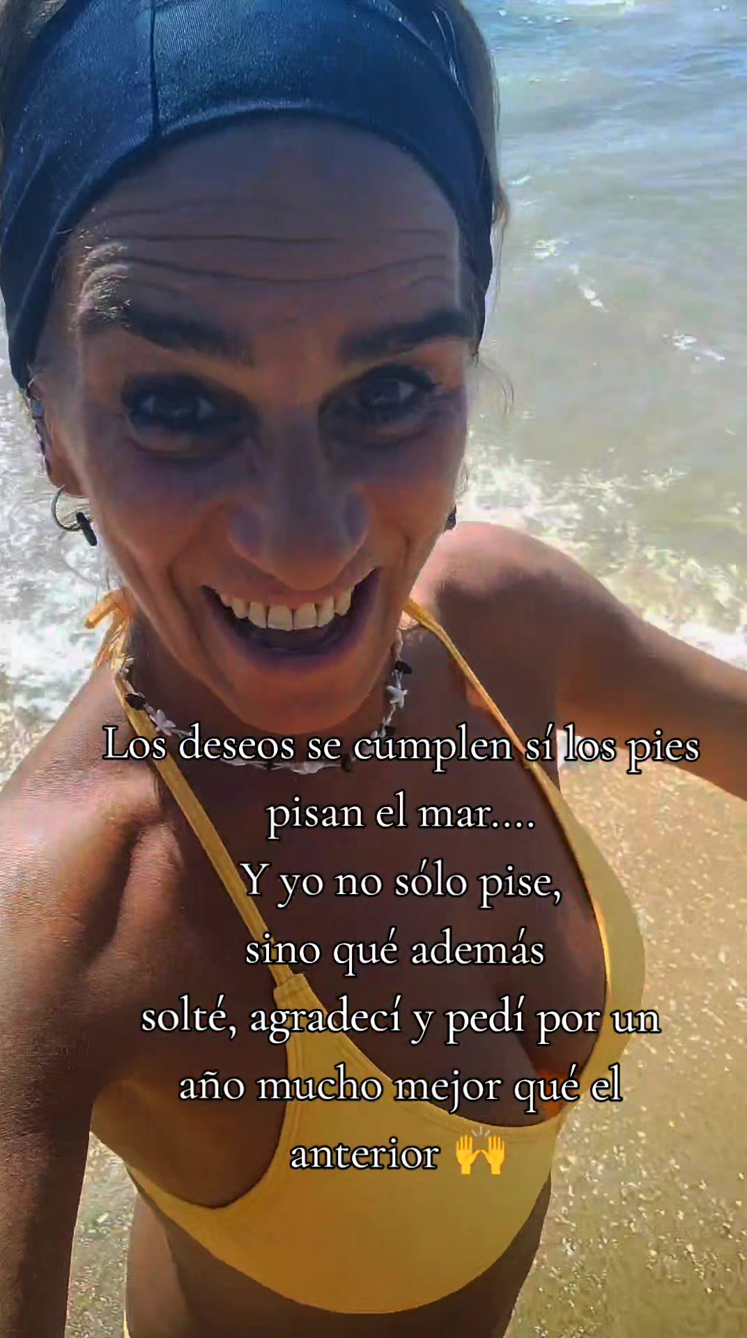 @Anita