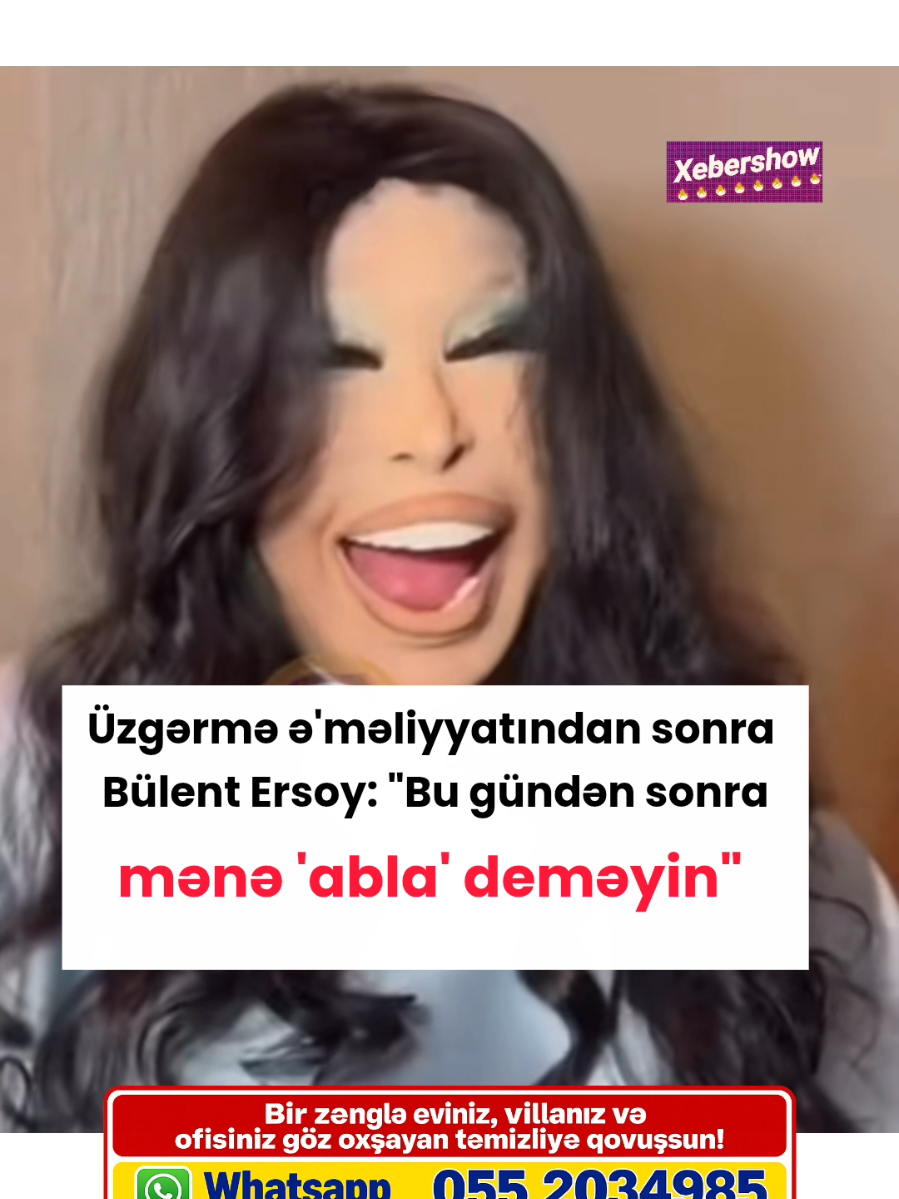 @Xebershow