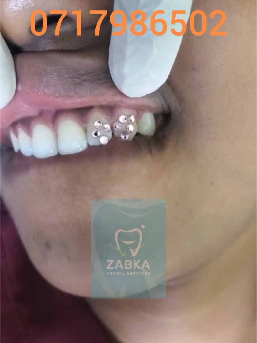 @Zabka Dental