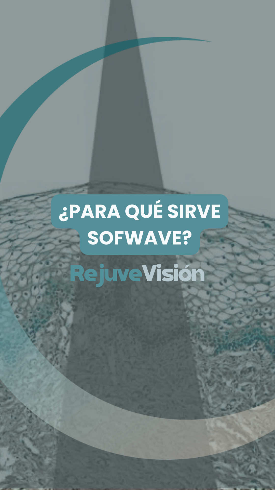 @visionlaser