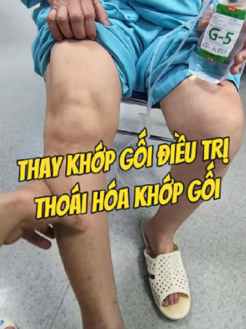 @Chuy&ecirc;n gia xương khớp