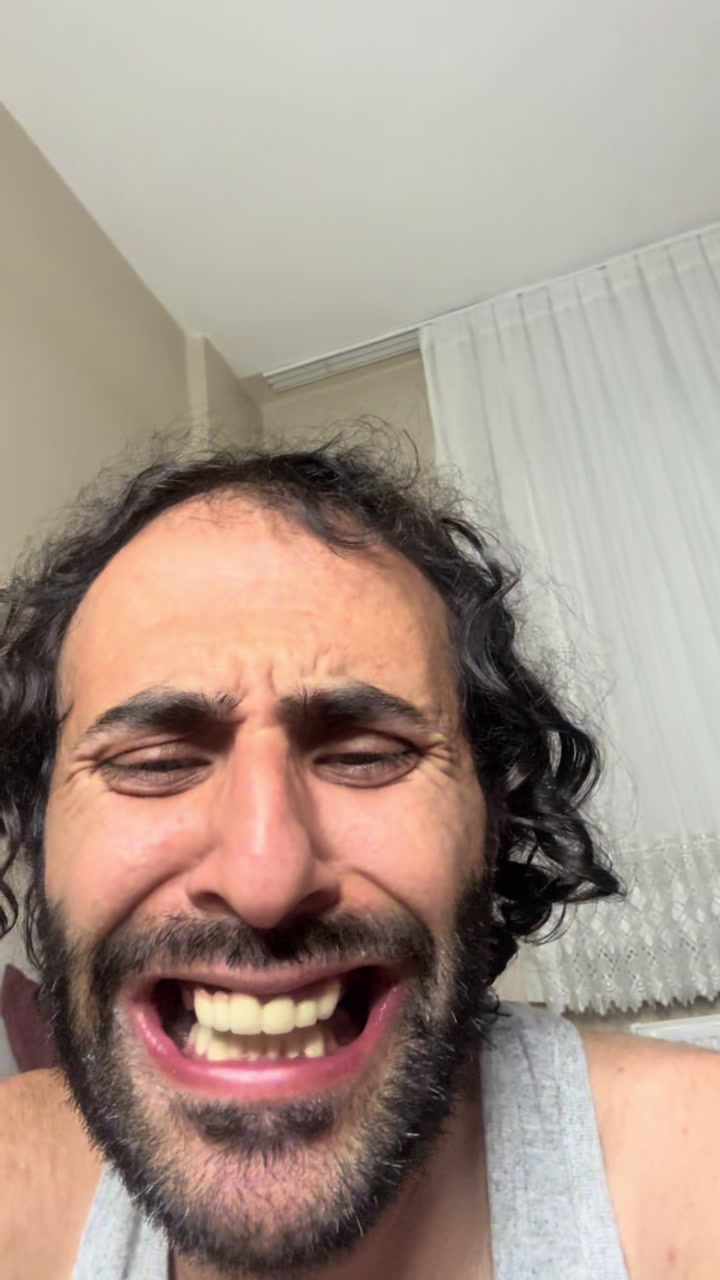 @HOPTİK ZOPTİK ÇUPALA BURHAN
