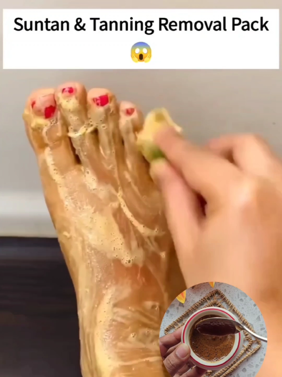 @Natural Beauty Remedy