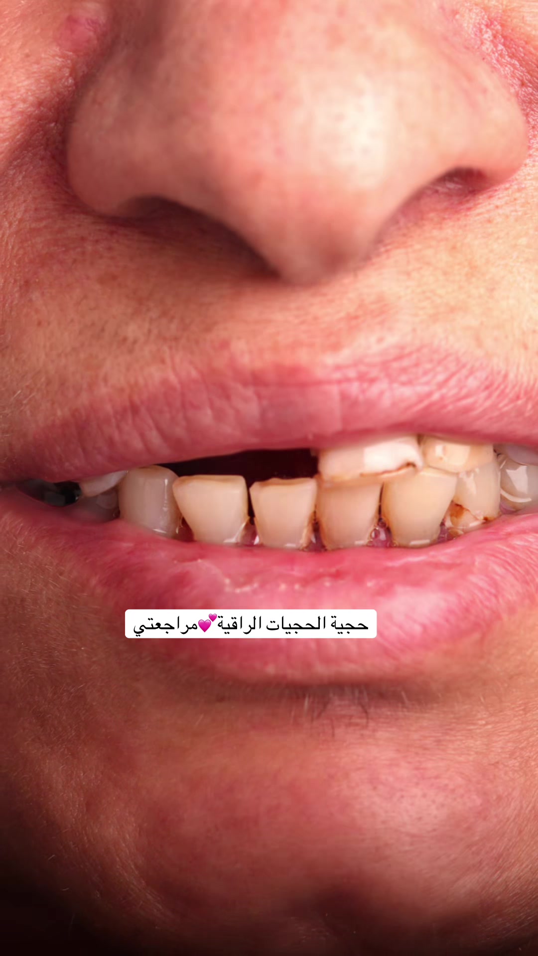 @Dr.Noor Mahjoba👩🏻⚕️🦷💉💎
