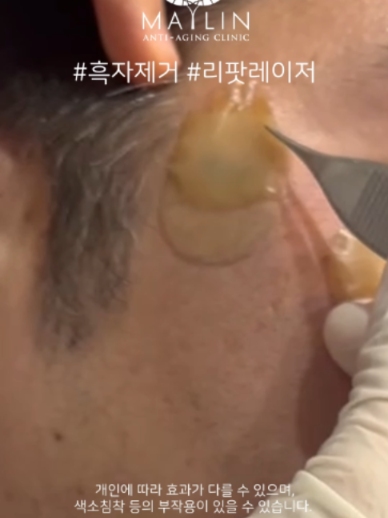 @메이린의원대구점
