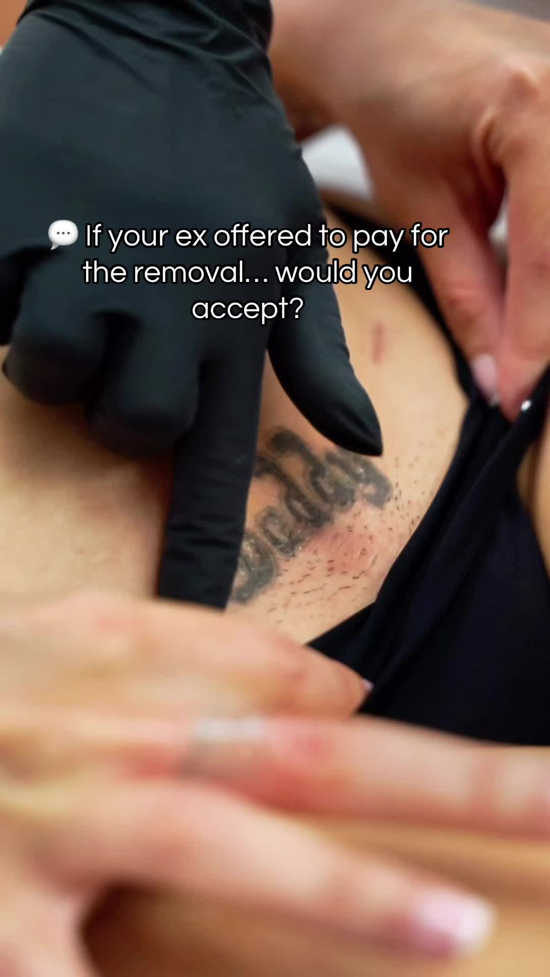 @@BHLASERTATTOOREMOVAL