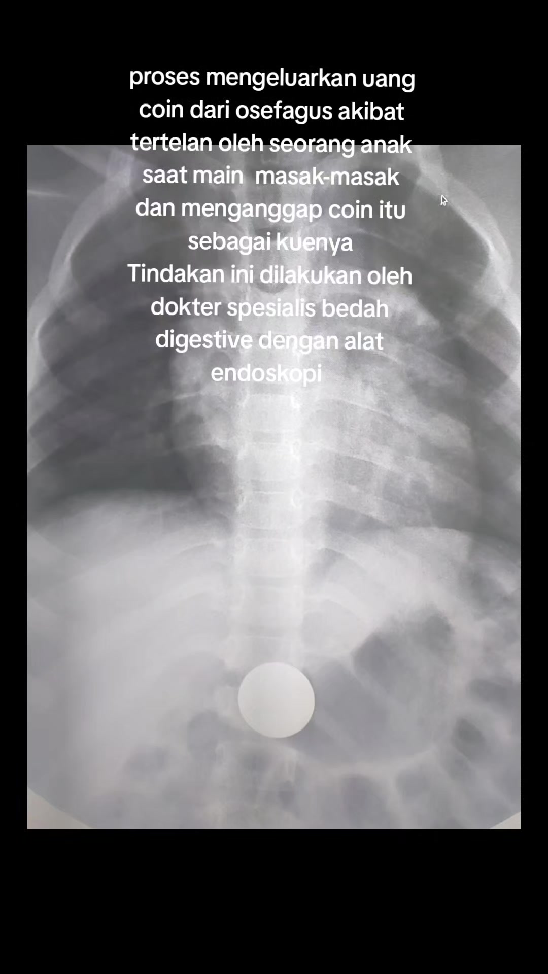@KAMAR OPERASI