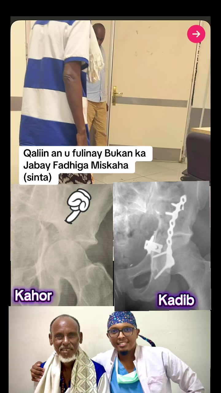 @DrHassan Fidow