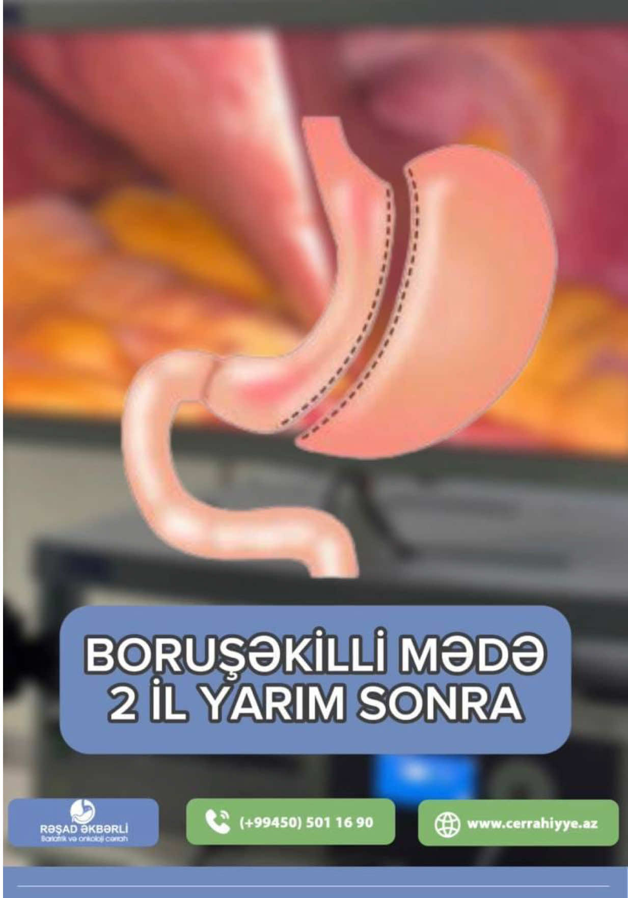 @Ümumi Cərrah Rəşad Əkbərli