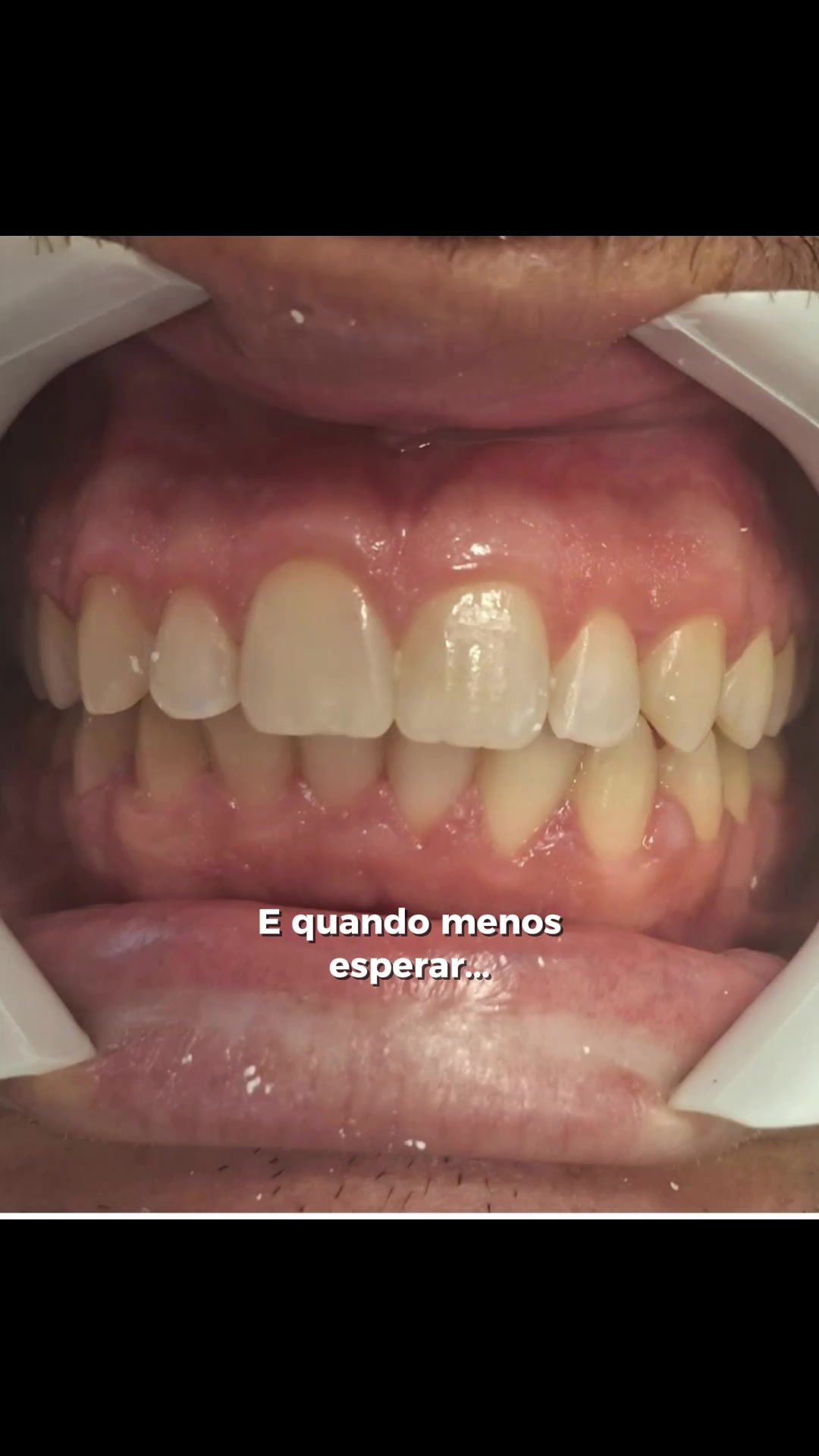 @Luana costa