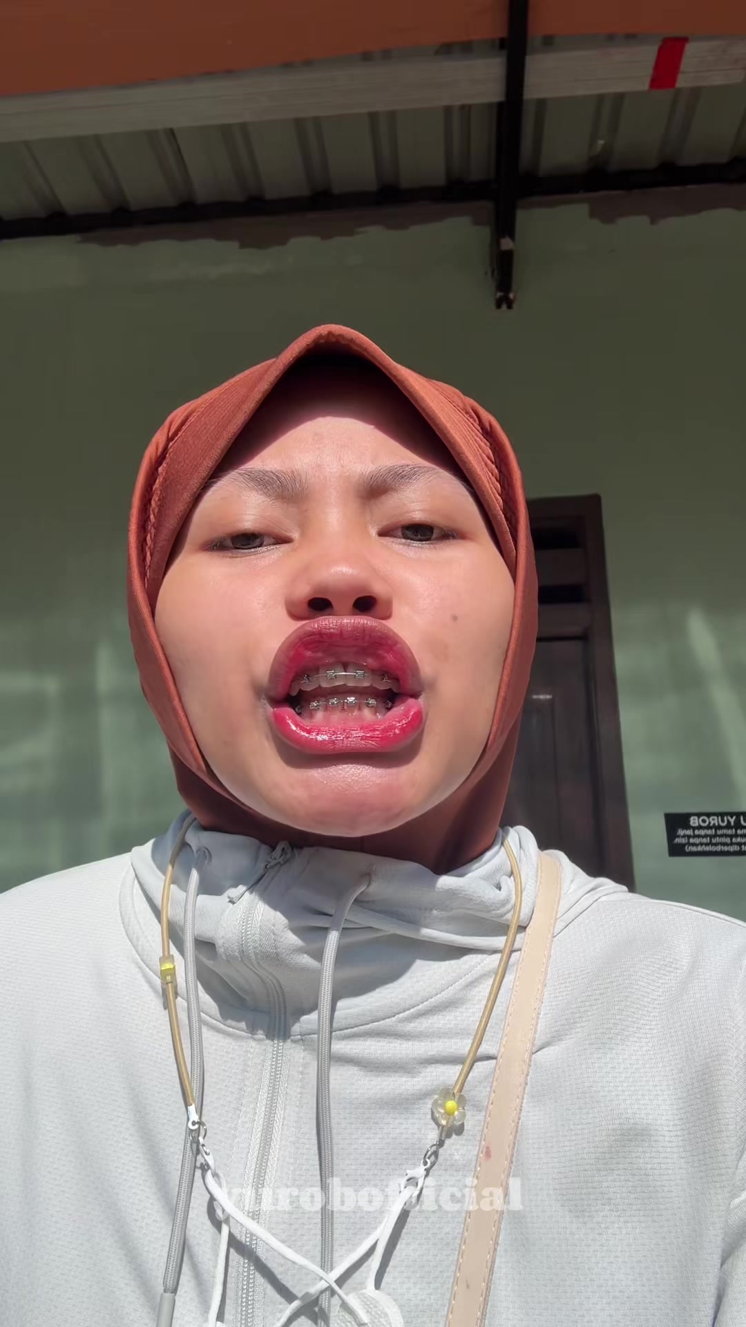 @Yu Rob ๐ฃ