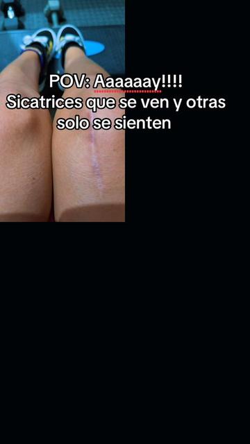 @salvi_bicha