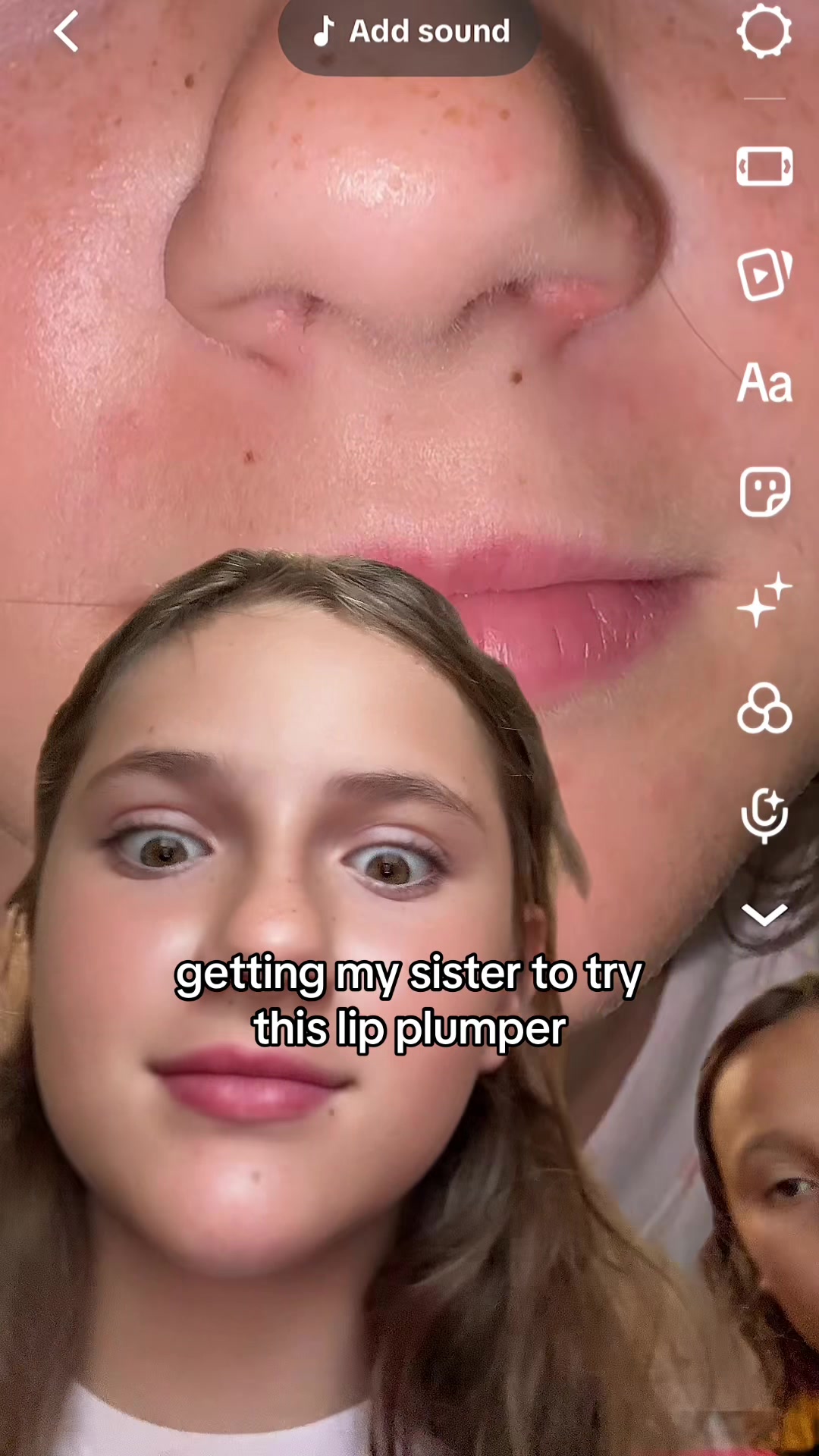 @ro🫧