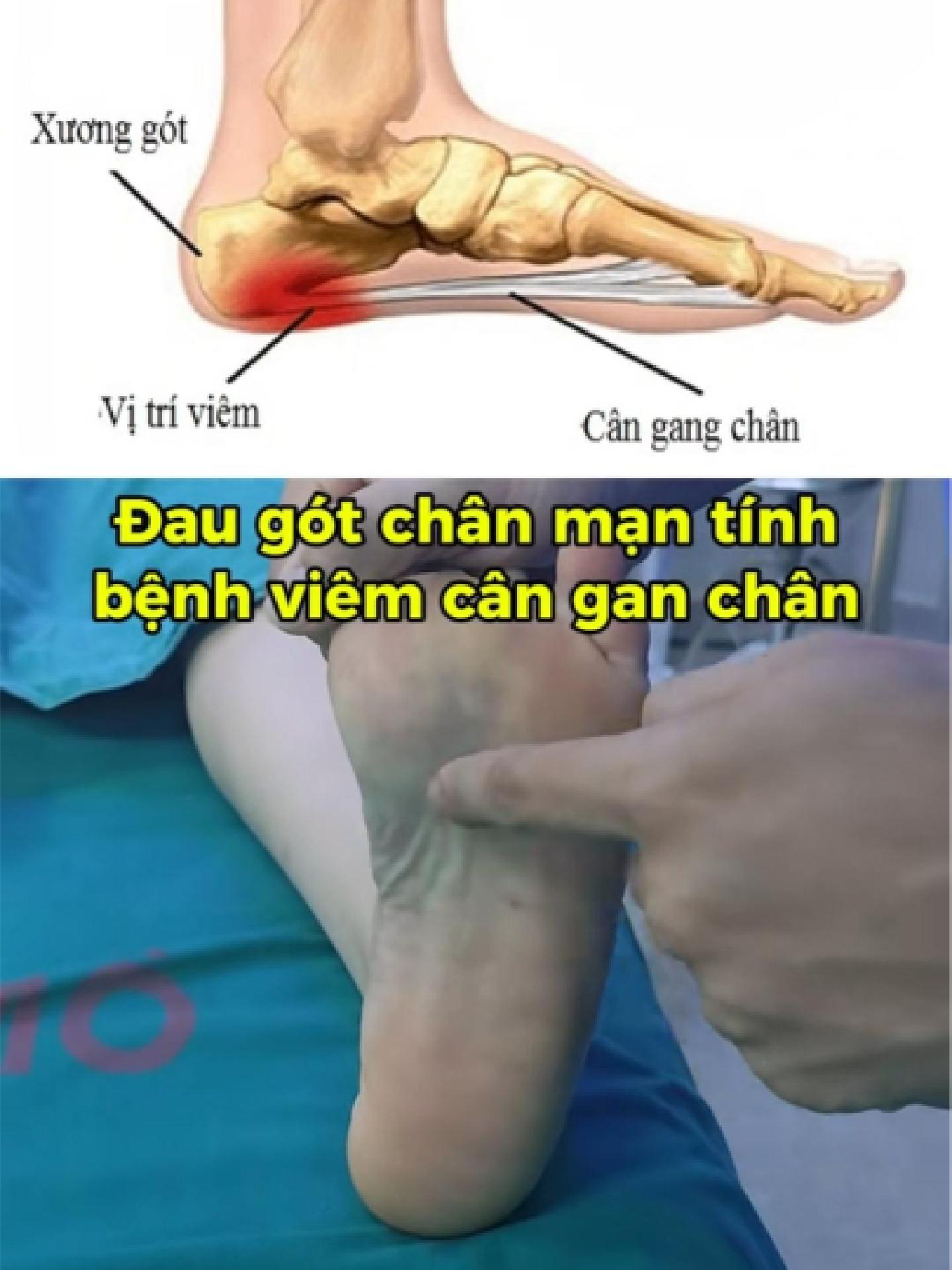 @Chuy&ecirc;n gia xương khớp