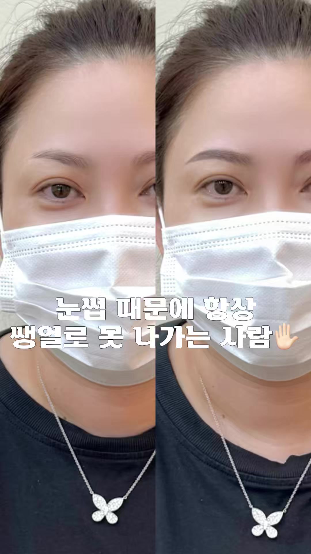 @강남눈썹문신|강남반영구 브로우뉴진