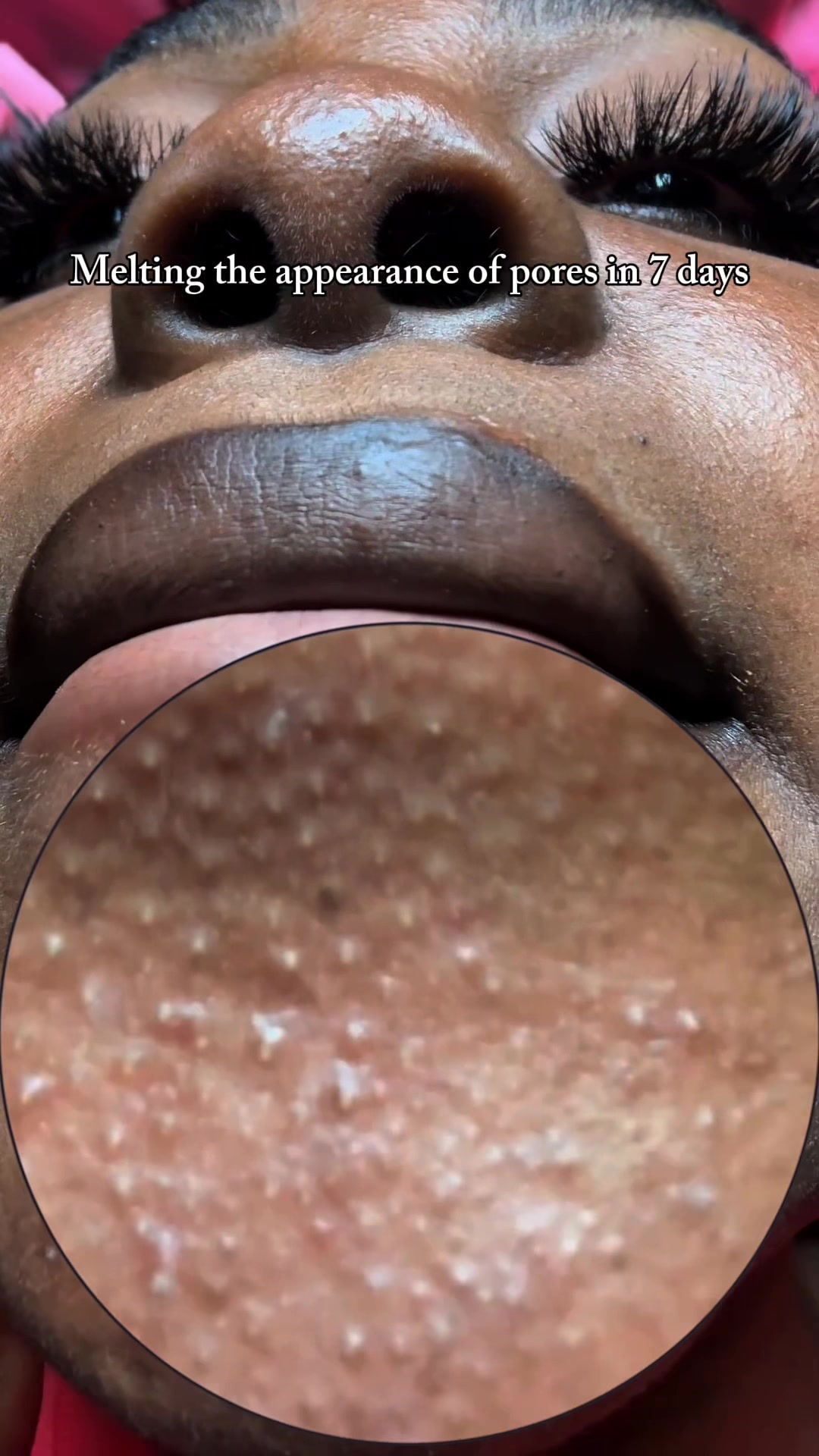 @Mimi | Beauty | Skincare