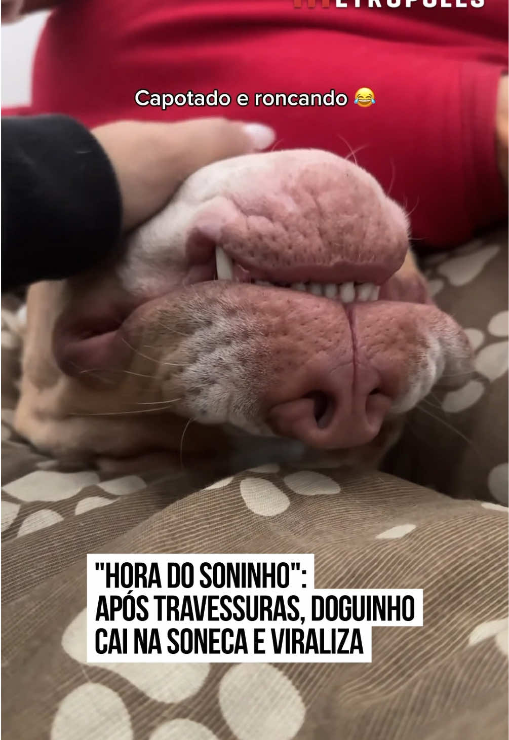 @Metrópoles Oficial