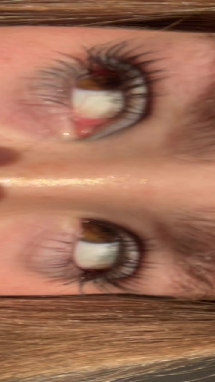@๐๐ง