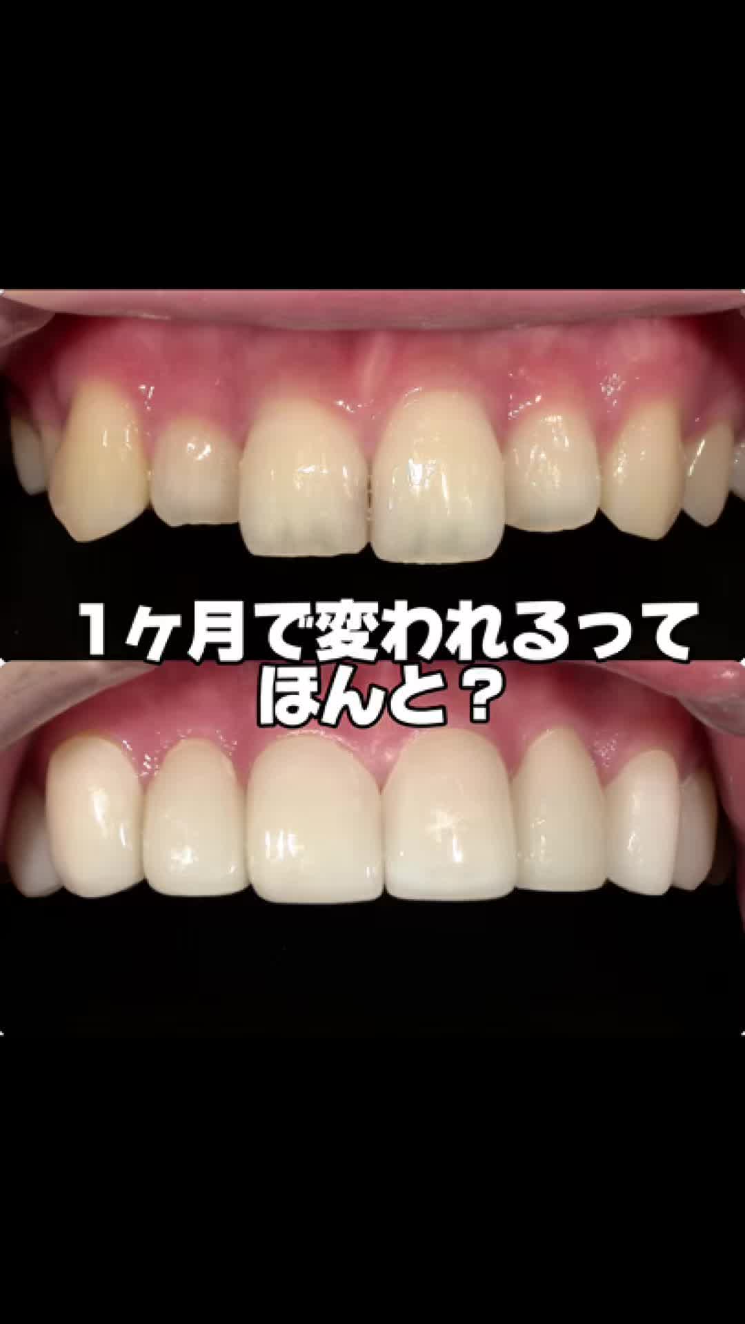 @DENTAL ALIEN